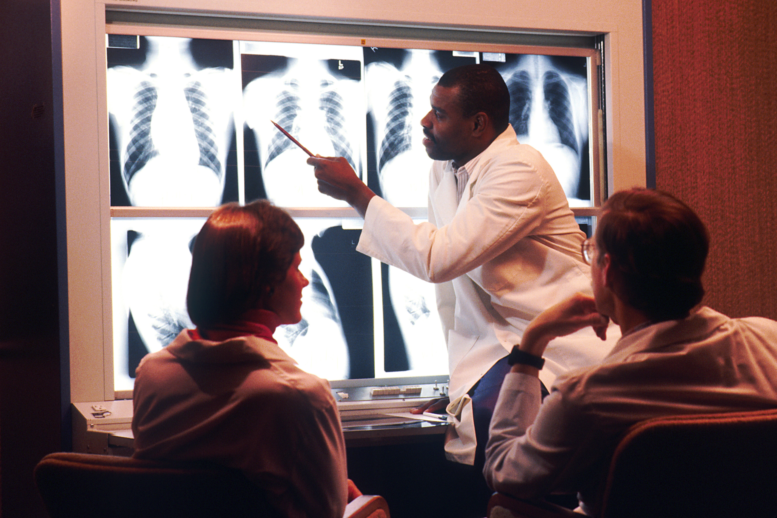 Três médicos discutem radiografias de tórax